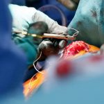 Unfallchirurgie – Schulter-OP